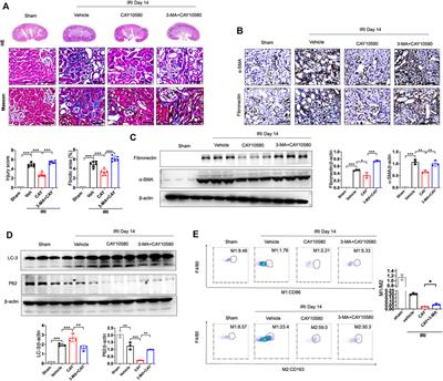 Activation of EP4 alleviates AKI-to-CKD transition through inducing CPT2-mediated lipophagy in renal macrophages